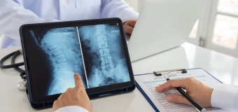 Workers Compensation Opt